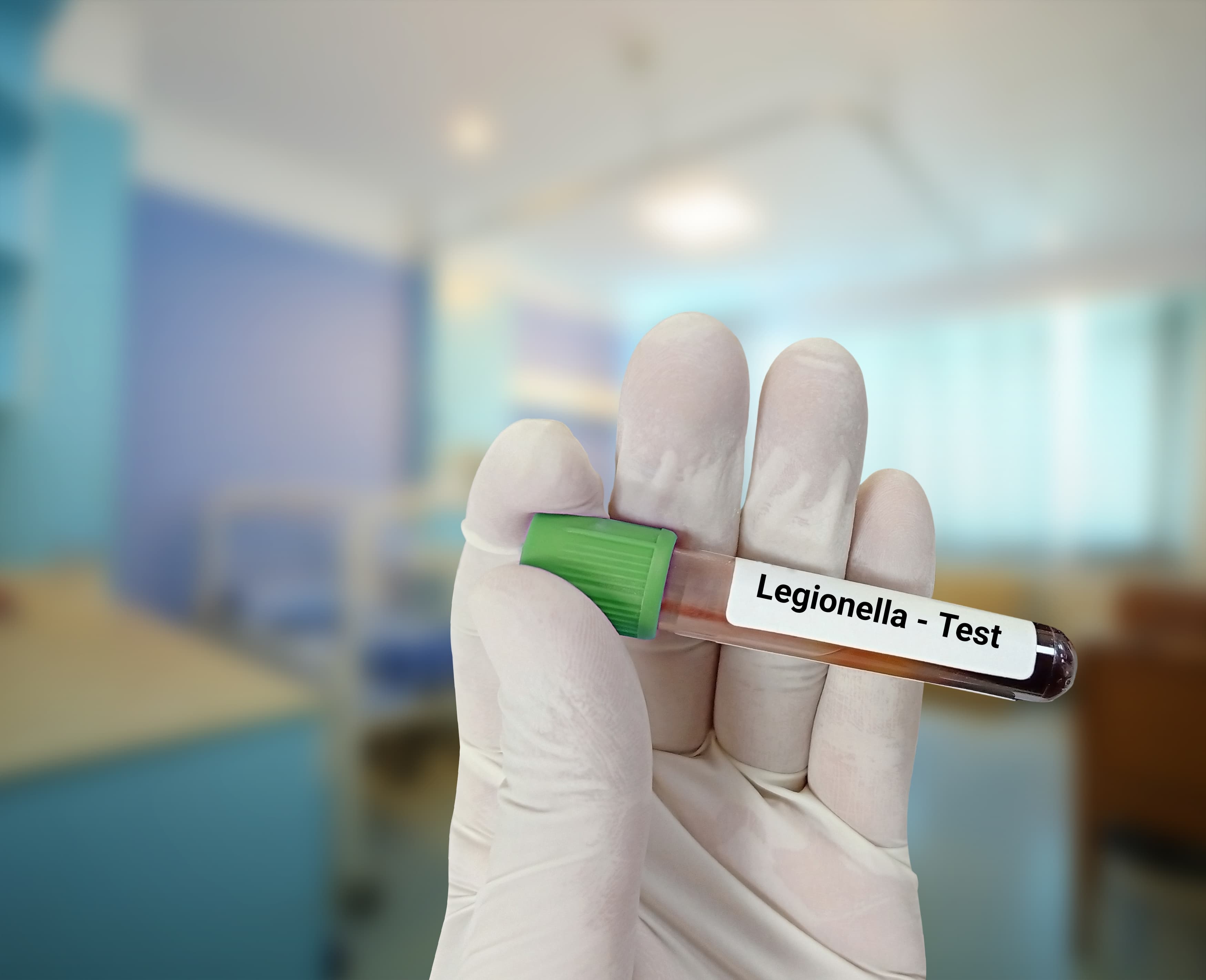 Number of UES buildings with positive Legionella tests more than doubles since preliminary findings